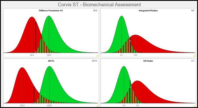 Four biomechanical parameters and the relation to normative data of healthy patients (green) and keratoconic patients (red) in 2014 (top) and 2018 (bottom) of right and left eye.