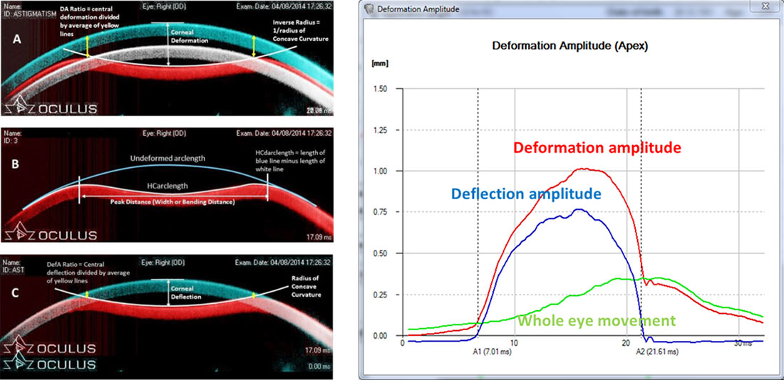 Deformation Amplitude (red) / Deflection Amplitude (blue) / Whole Eye Movement (green)